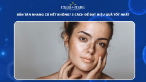 bắn tàn nhang có hết không