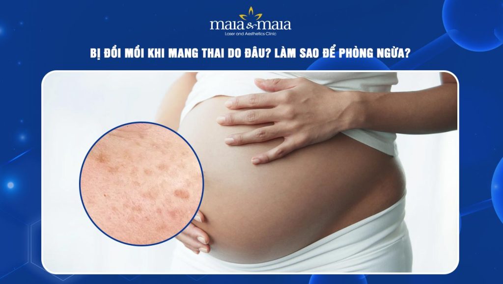 bị đồi mồi khi mang thai