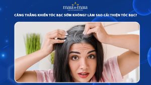 căng thẳng khiến tóc bạc sớm