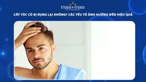 cấy tóc có bị rụng lại không