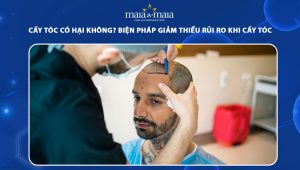 cấy tóc có hại không