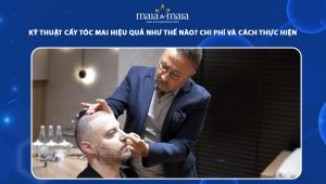 cấy tóc mai