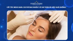 cấy tóc meso hair