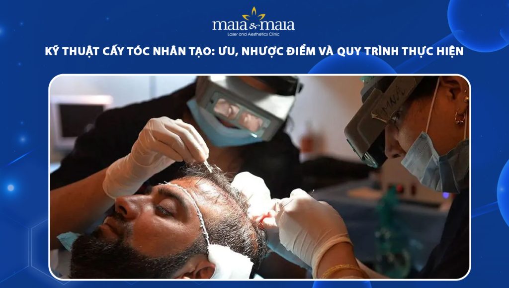 cấy tóc nhân tạo