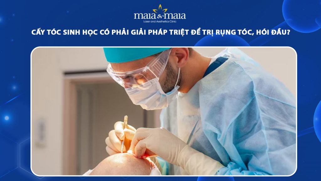 cấy tóc sinh học