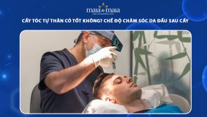 cấy tóc tự thân