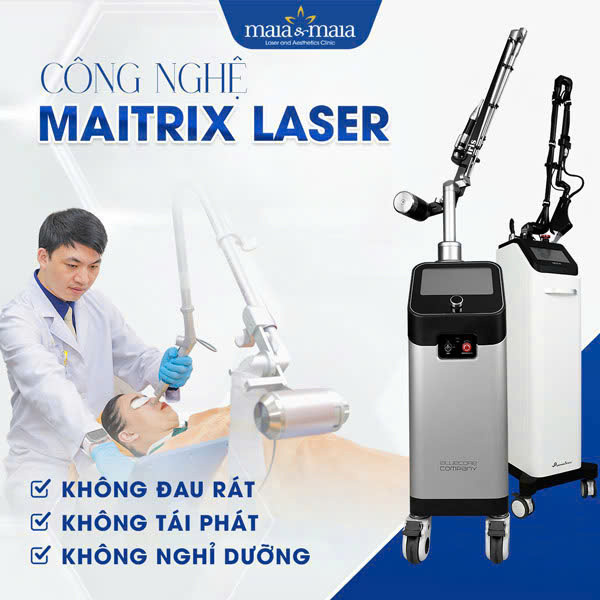 công nghệ maitrix laser