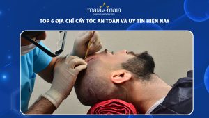 địa chỉ cấy tóc