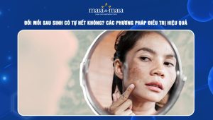 đồi mồi sau sinh