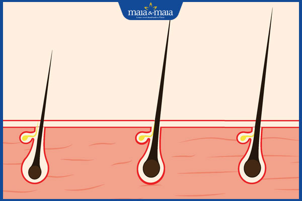8 cách mọc tóc nhanh giải quyết nỗi lo rung tóc, hói đầu 2 giai đoạn phát triển của tóc