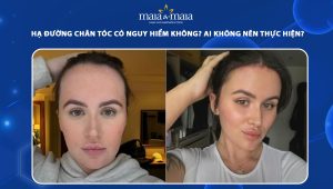 hạ đường chân tóc có nguy hiểm không