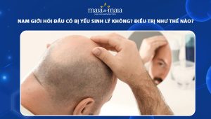 hói đầu có bị yếu sinh lý