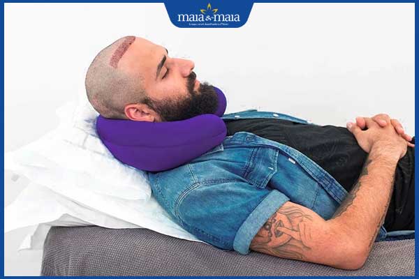 kê cao đầu sau cấy tóc