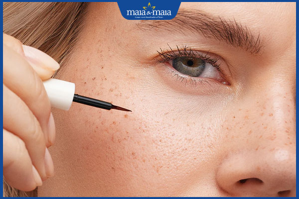 makeup chấm tàn nhang