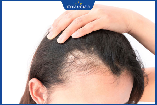 nguyên nhân thận yếu gây rụng tóc