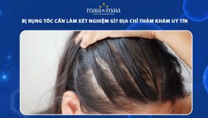 rụng tóc cần làm xét nghiệm gì
