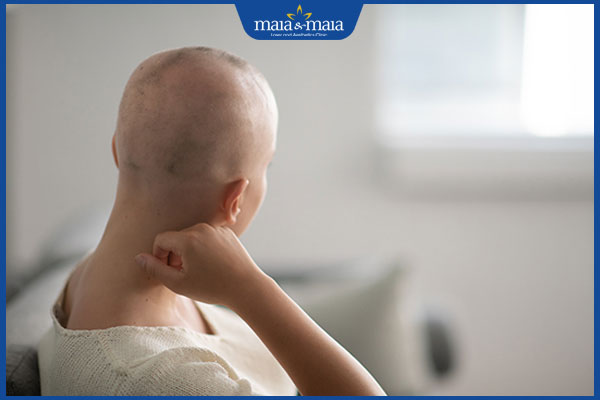 rụng tóc do hóa chất