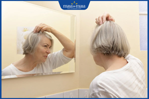 rụng tóc gây mất tự tin