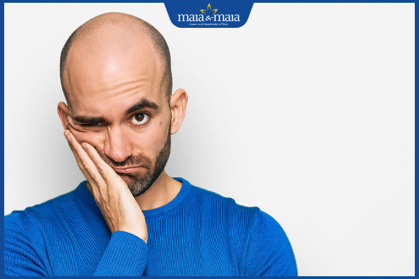 rụng tóc gây tự ti