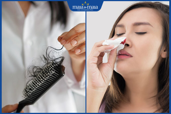 rụng tóc và chảy máu cam