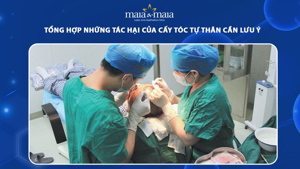 tác hại của cấy tóc tự thân