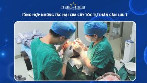 tác hại của cấy tóc tự thân