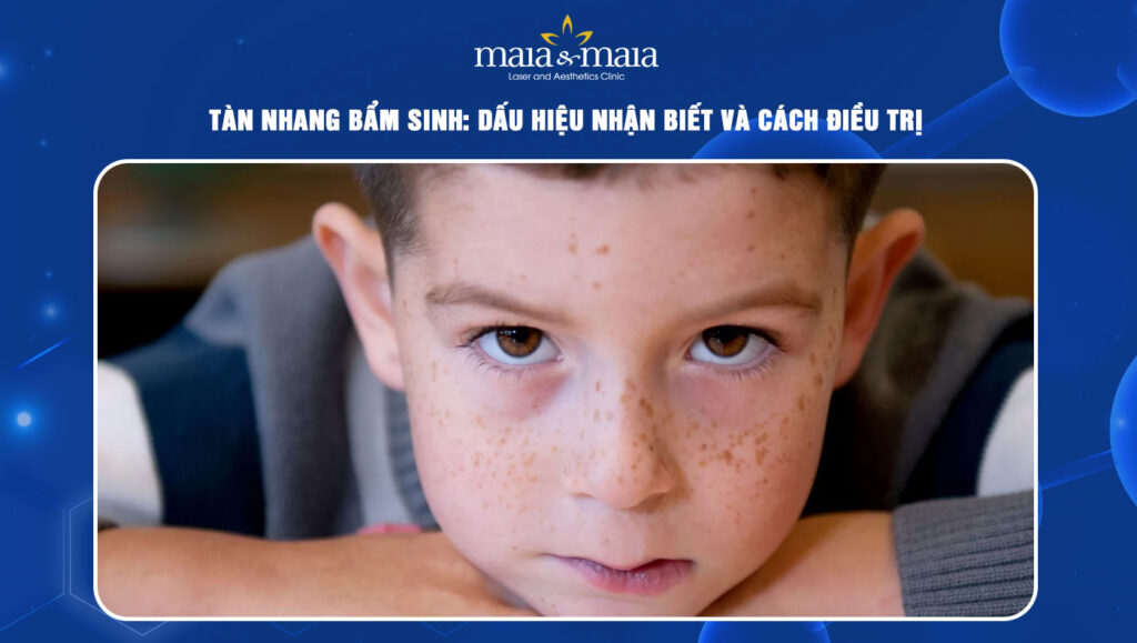 Tàn nhang bẩm sinh: Dấu hiệu nhận biết và cách điều trị 1 tàn nhang bẩm sinh