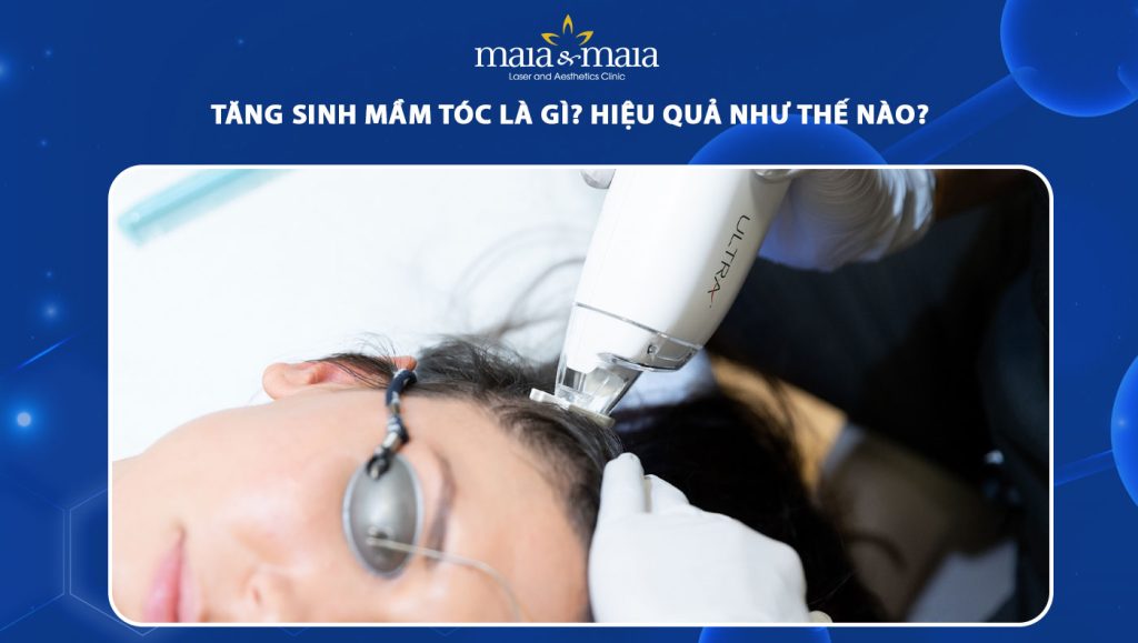tăng sinh mầm tóc