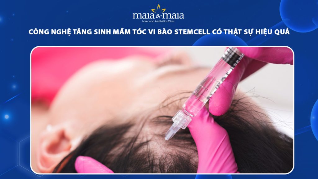 Tăng sinh mầm tóc vi bào Stemcell có hiệu quả không? 1 tăng sinh mầm tóc vi bào stemcell