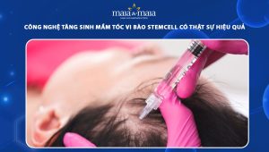 tăng sinh mầm tóc vi bào stemcell