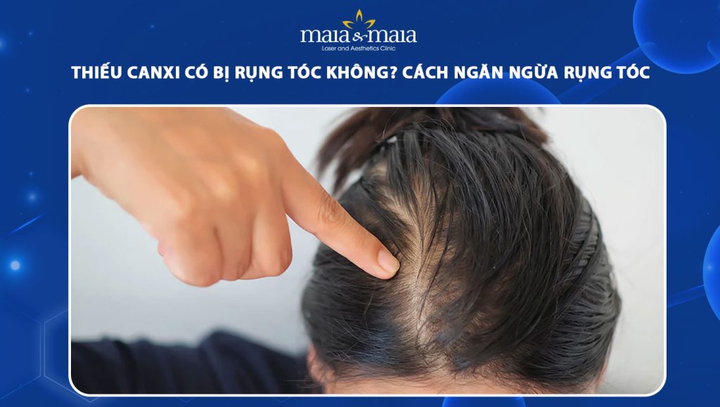 Thiếu canxi có bị rụng tóc không? Cách ngăn ngừa rụng tóc 1 thiếu canxi có bị rụng tóc không