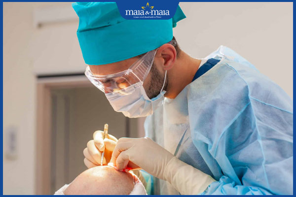 thực hiện cấy tóc FUE