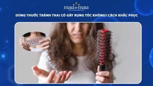 thuốc tránh thai có gây rụng tóc