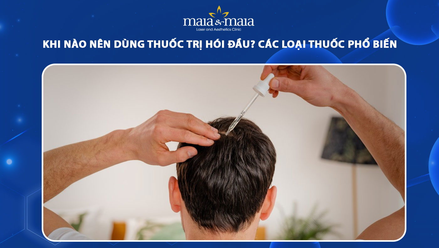 thuốc trị hói đầu