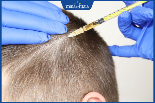 tiêm meso kích thích mọc tóc