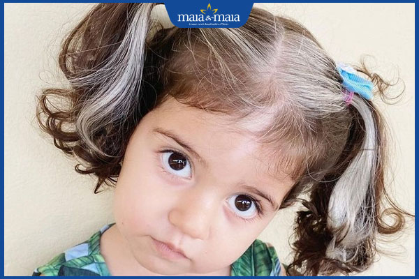 Tóc bạc sớm ở trẻ em: Nguyên nhân và cách điều trị hiệu quả 2 tình trạng tóc bạc sớm ở trẻ em