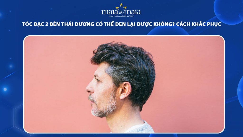 tóc bạc 2 bên thái dương