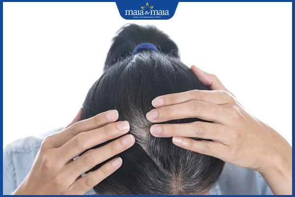 tóc bạc sau sinh không nên nhổ