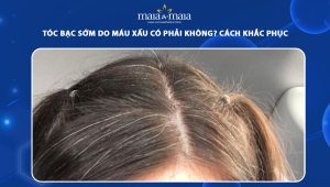 tóc bạc sớm do máu xấu