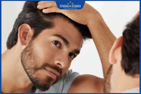 tóc bạc sớm ở nam