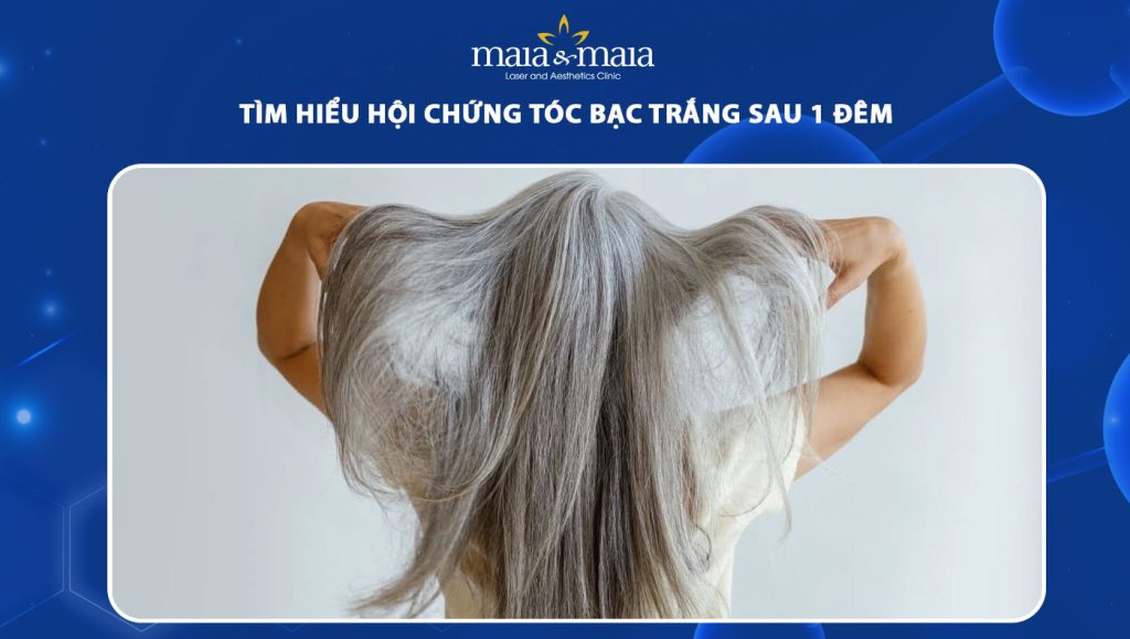 tóc bạc trắng sau 1 đêm