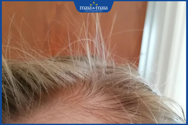 tóc con mọc trên đầu