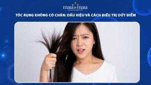 tóc rụng không có chân