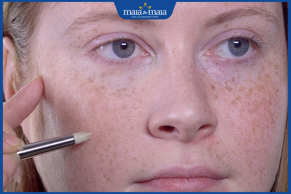 trang điểm tàn nhang