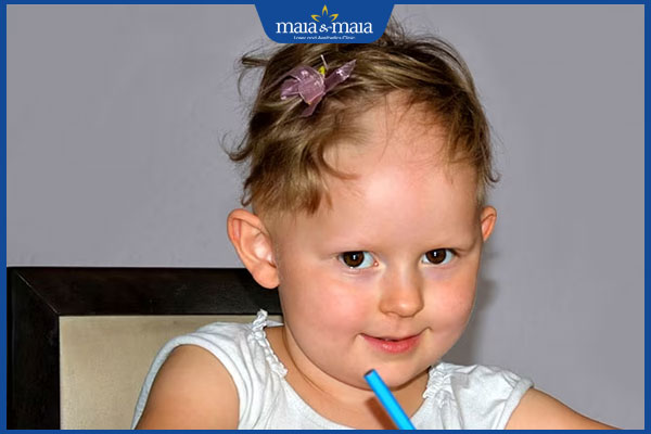 trẻ em bị rụng tóc