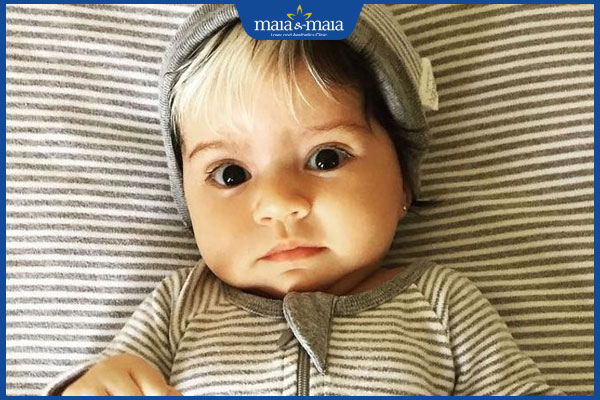 Tóc bạc sớm ở trẻ em: Nguyên nhân và cách điều trị hiệu quả 3 trẻ sơ sinh bị bạc tóc sớm