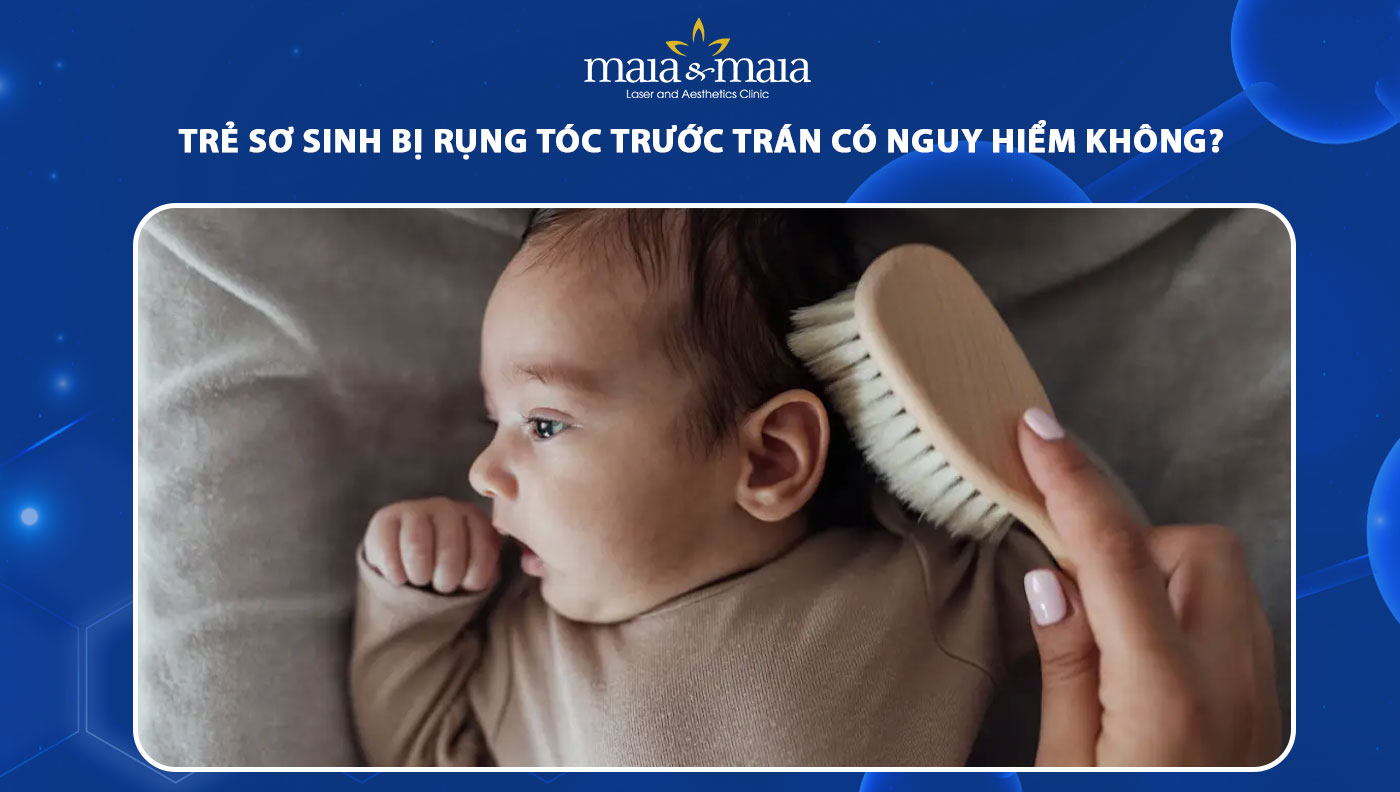 trẻ sơ sinh bị rụng tóc trước trán