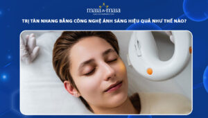 trị tàn nhang bằng công nghệ ánh sáng