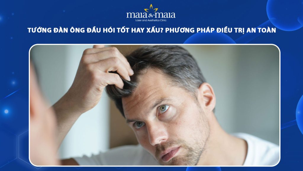 tướng đàn ông đầu hói