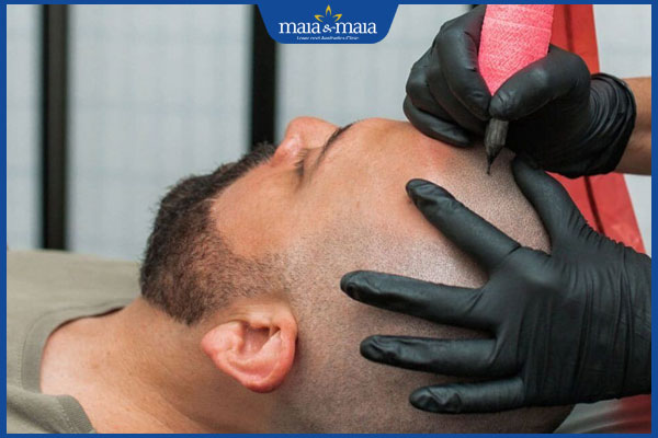 Ưu và nhược điểm khi thực hiện xăm tóc cho người hói đầu 2 xăm tóc